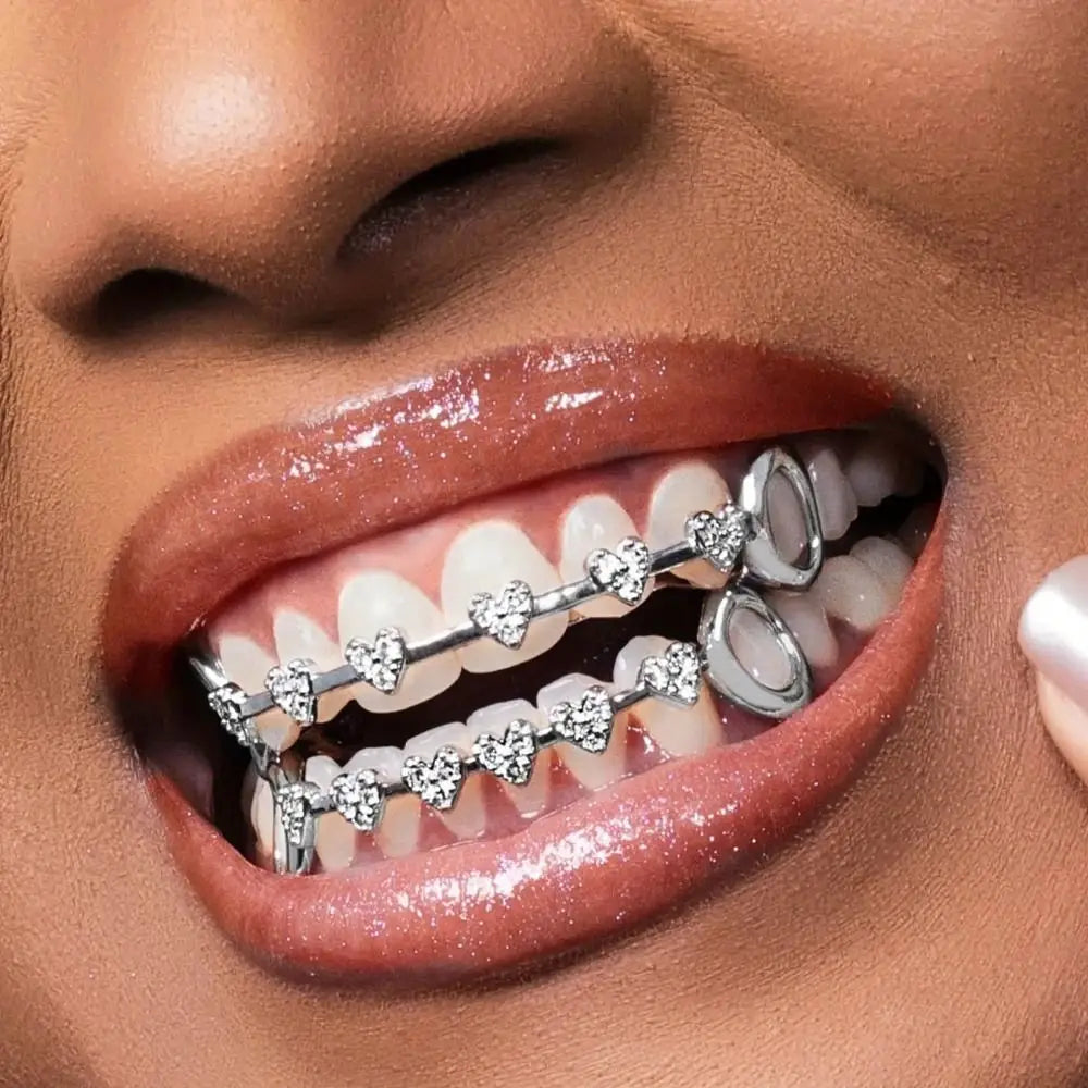 On Trend Faux Teeth Braces