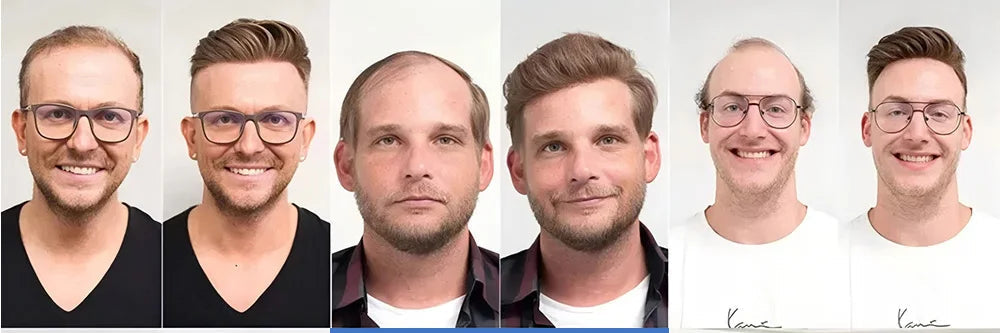 Full Lace Toupee For Men Human Hair Unit